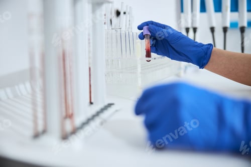 Preview: Scientist in latex gloves holding a glass vial with a lavender cap