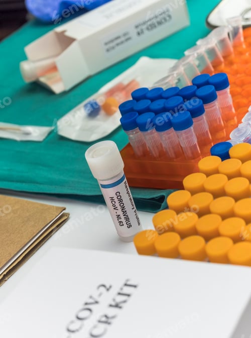 Preview: Novel coronavirus 2019 nCoV pcr diagnostics kit. This is RT-PCR kit