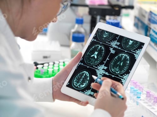 Preview: Doctor viewing patient's brain scan on digital tablet in laboratory