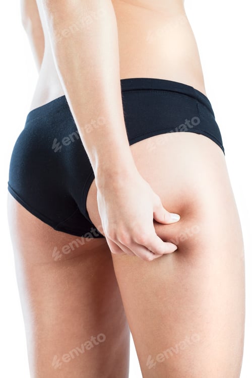 Preview: Close-Up Of Female Legs Without Cellulite