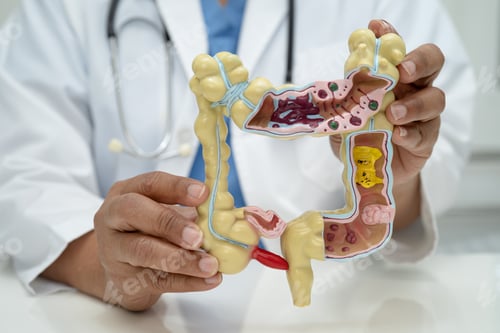 Preview: Intestine, appendix and digestive system, doctor holding anatomy model for study