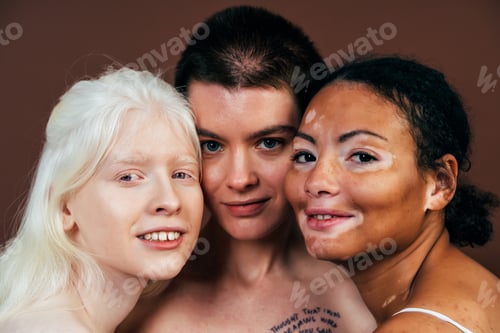 Preview: Group of multiethnic women