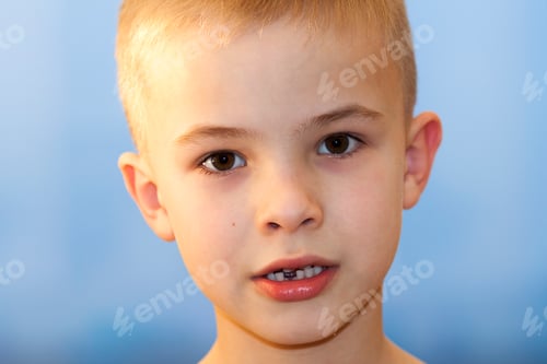 Preview: Close-up of boy smiling with missing front milk tooth over light background.