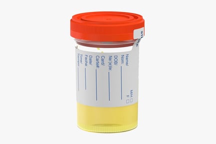 Preview: Sterile Specimen Container with Urine Sample