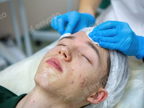 Preview: A young Caucasian teenage boy has a cosmetologist cleaning his face. A dermatologist treats acne on