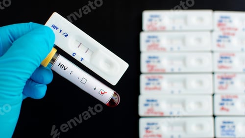 Preview: HIV virus, medical concept, Human Immunodeficiency Virus Positive test