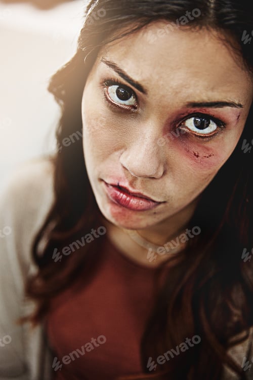 Preview: Will nobody help me. Cropped portrait of a beaten and bruised young woman.