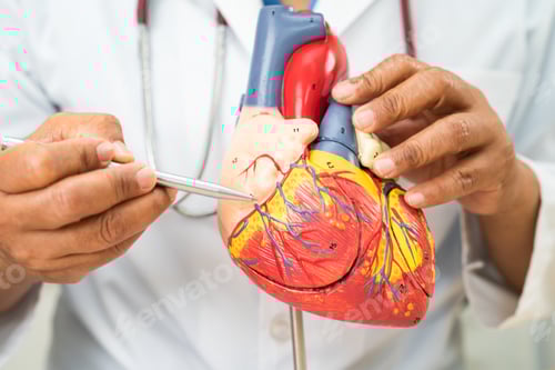 Preview: Cardiovascular disease CVD, Asian doctor holding human anatomy model for learn and treat heart
