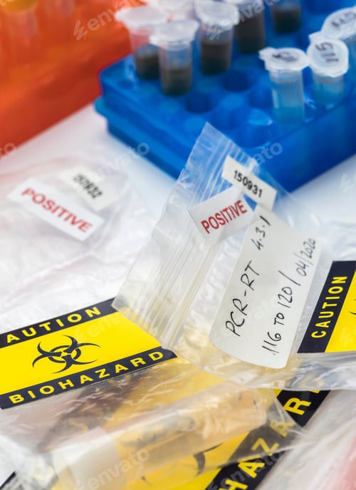 Preview: Vials with samples of SARS-COV-2 Covid-19 in a research laboratory, conceptual image