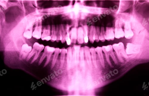 Preview: Dental X-ray