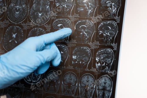 Preview: Cropped view of doctor pointing on magnetic resonance imaging of brain isolated on white, alzheimer