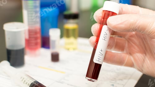 Preview: HIV virus, medical concept, Human Immunodeficiency Virus Positive test