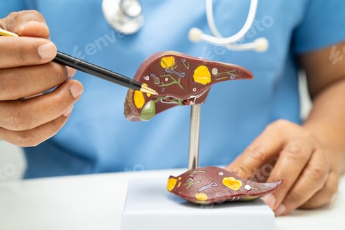 Preview: Cirrhosis, Liver cancer, fatty liver, Asian doctor with liver human anatomy