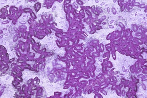 Preview: Microscopic view of purple bacteria clusters in a petri dish with detailed