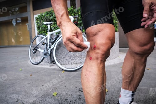 Preview: Close-up of cyclist cleaning his wounds on leg after falling from bike ride.
