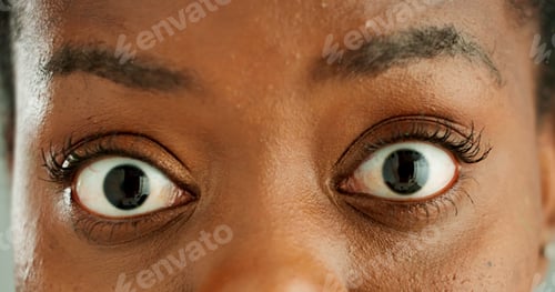 Preview: Shock, woman and closeup of face with eyes for strain, optical care and health. Surprise, crazy and