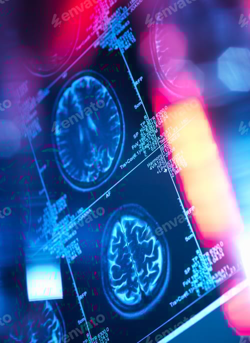 Preview: Human brain scan in a neurology clinic
