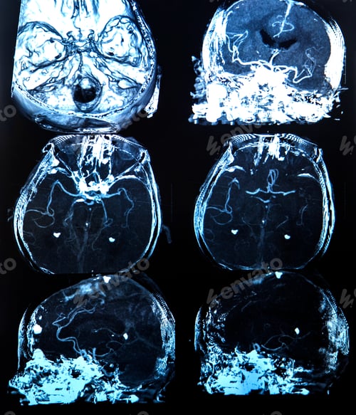 Preview: Set of X Ray images