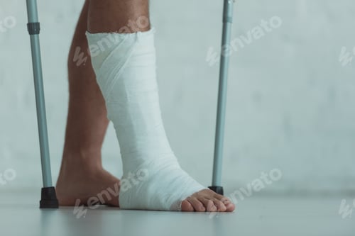 Preview: Cropped view of man with gypsum on leg holding crutches