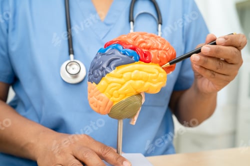 Preview: Alzheimer disease, Asian doctor holding brain anatomy model