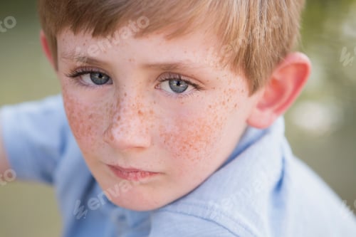 Preview: A young boy with freckles on his face.