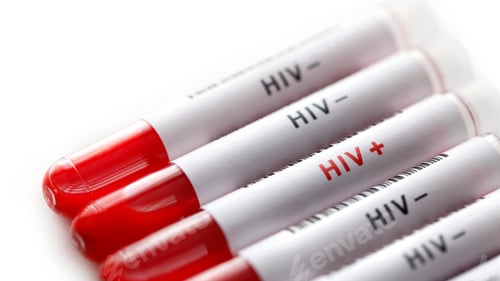 Preview: HIV virus, medical concept, Human Immunodeficiency Virus Positive test