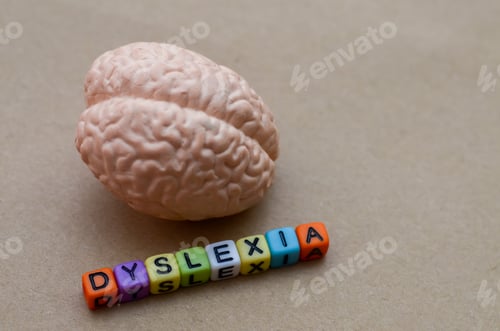 Preview: Brain Model,Letters Spelling DYSLEXIA, Representing Neurological Basis of Learning Disability