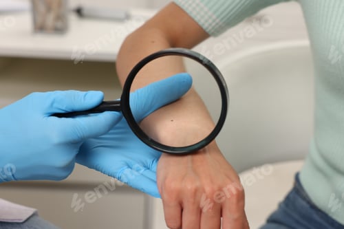 Preview: Doctor examining young woman's mole with magnifying glass in hospital, closeup