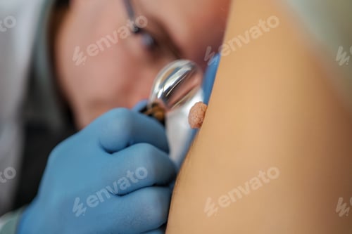 Preview: Skin examination in a medical setting during daylight hours
