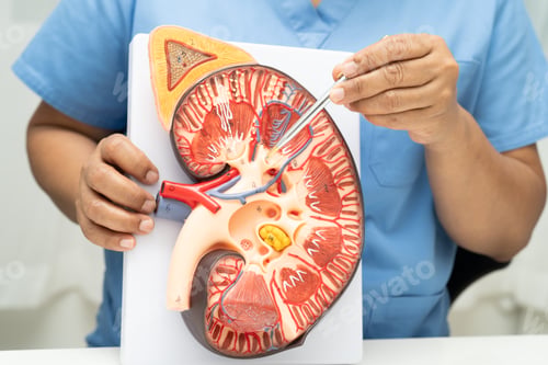 Preview: Kidney disease, Chronic kidney disease ckd, Doctor hold human model to treat and study in hospital.