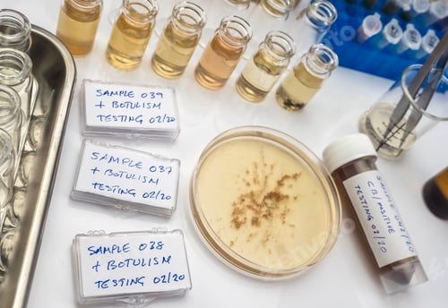 Preview: Samples contaminated by Clostridium botulinum toxin that causes botulism in humans