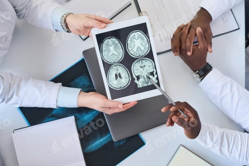 Preview: Doctors examining brain tomography image in team