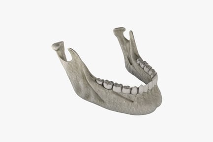 Preview: Lateral view of maxilla with dentition