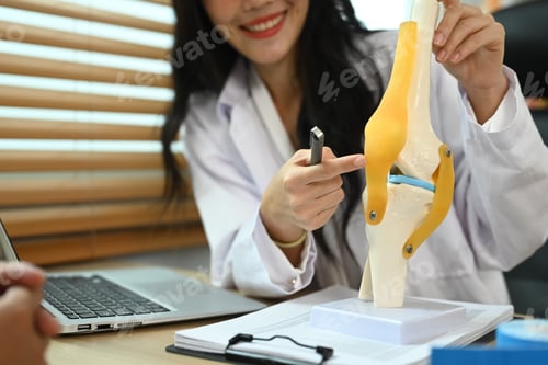 Preview: Female doctor showing knee joint model to patient and explains to patient about treatment