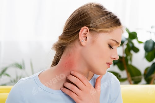 Preview: Woman with allergy redness on neck at home