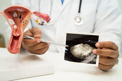 Preview: Uterus, doctor with anatomy model for study diagnosis and treatment in hospital.