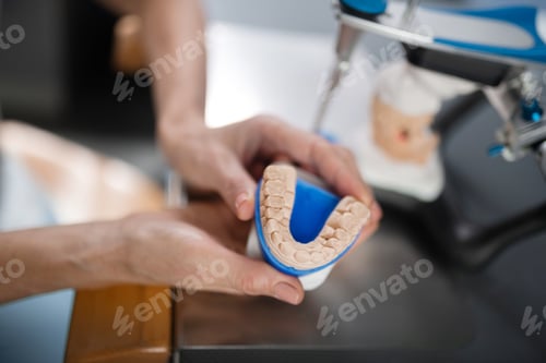 Preview: Cast model of patients teeth in hands of the dentist