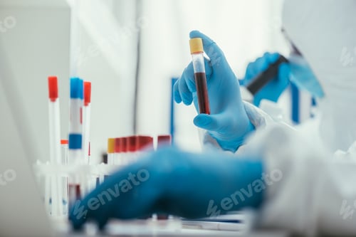 Preview: selective focus of biochemist holding test tube with blood sample near colleague