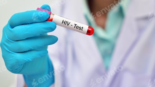 Preview: HIV virus, medical concept, Human Immunodeficiency Virus Positive test