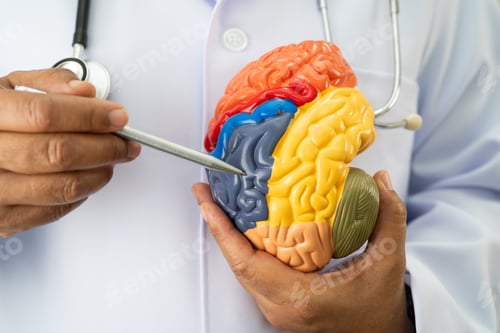 Preview: Alzheimer disease, Asian doctor holding brain anatomy model
