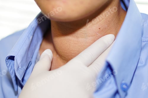 Preview: Asian lady woman patient have abnormal enlargement of thyroid gland Hyperthyroidism at the throat