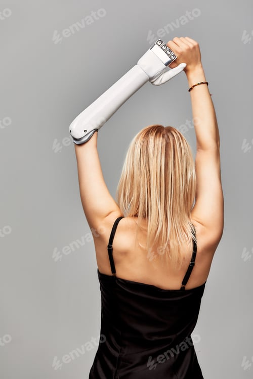 Preview: Studio portrait of beautiful young blonde girl with disability wearing sensory bionic prosthetic arm