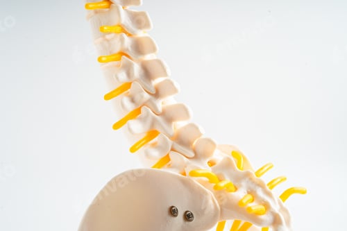 Preview: Lumbar spine displaced herniated disc fragment, spinal nerve and bone. Model