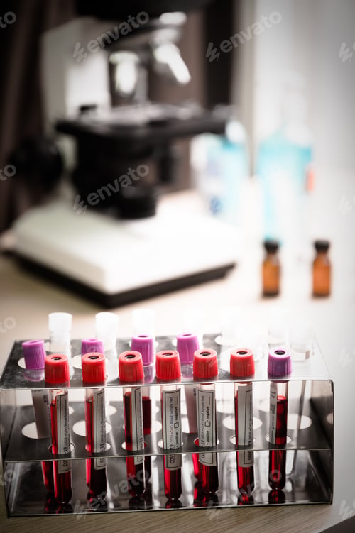 Preview: COVID-19 blood sample test, 2019-nCoV Coronavirus check-up in laboratory