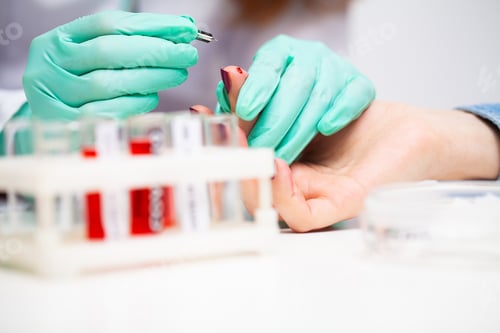 Preview: Woman at the hospital submits a blood test for a coronavirus