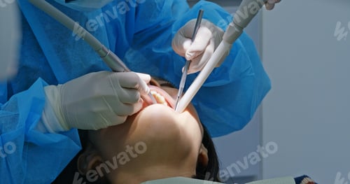 Preview: Woman have dental check up in the clinic