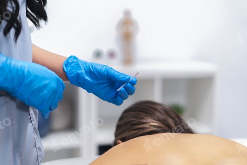 Preview: Physiotherapist holding acupuncture needle preparing treatment for patient back pain