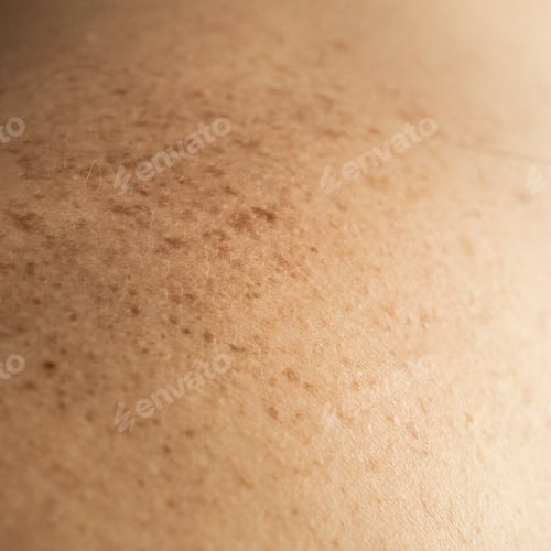 Preview: Skin on a man back with scattered moles