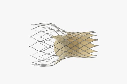 Preview: Aortic Valve Implant: Transcatheter Replacement