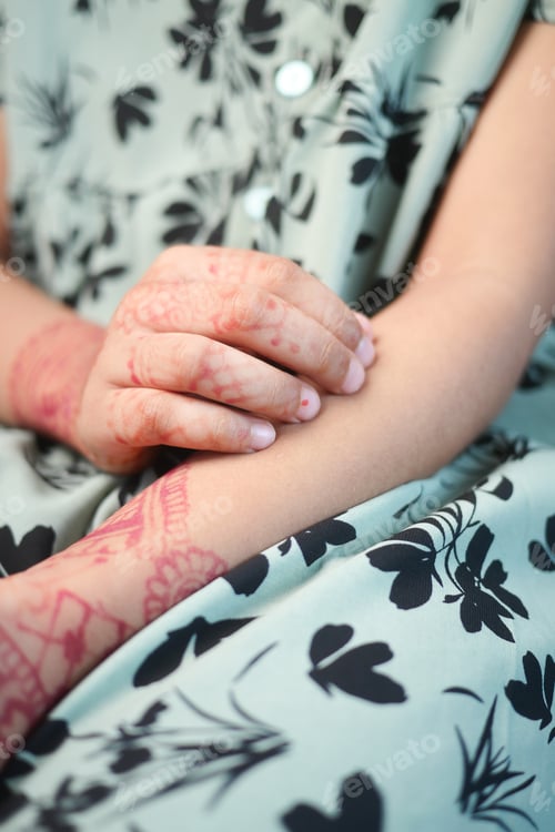 Preview: little girl suffering from itching skin on her hand